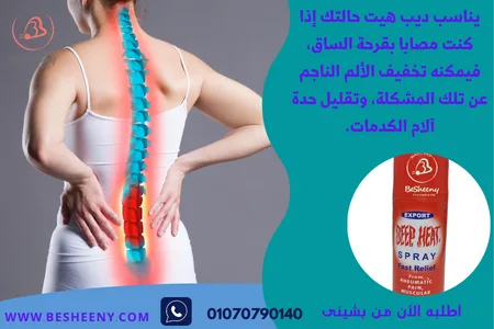 لعلاج ألام العظام والعضلات ديب هيت سبراى
