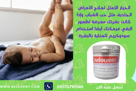 سودو كريم لالتهابات الحفاض