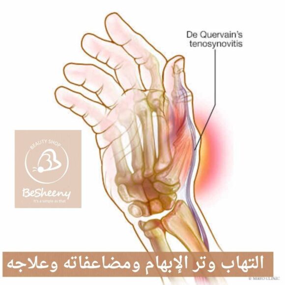 التهاب وتر الإبهام ومضاعفاته وعلاجه