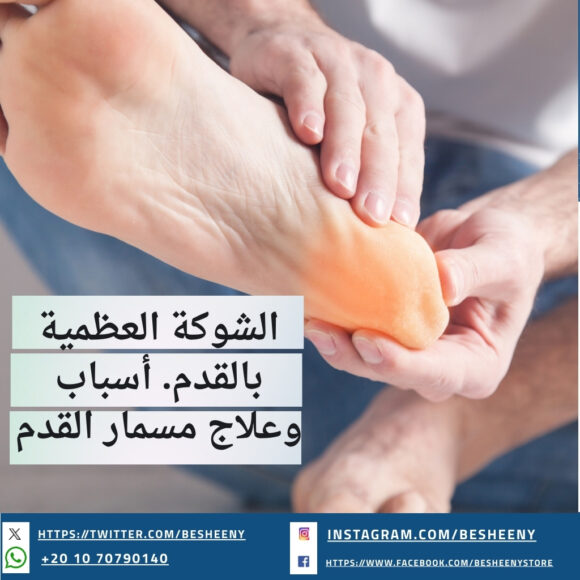 الشوكة العظمية بالقدم. أسباب وعلاج مسمار القدم