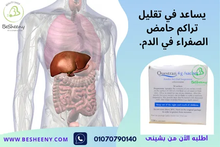 كويستران الانجليزي أكياس لمرضى المرارة