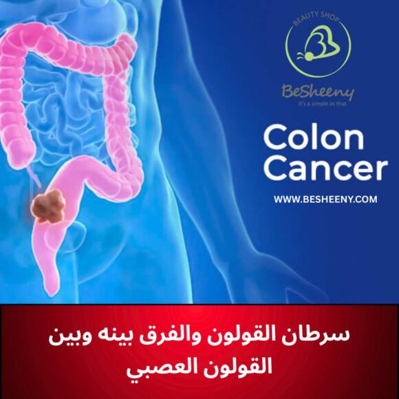 سرطان القولون والفرق بينه وبين القولون العصبي