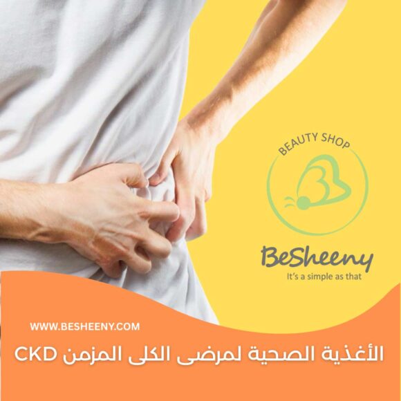 الأغذية الصحية لمرضى الكلى المزمن CKD