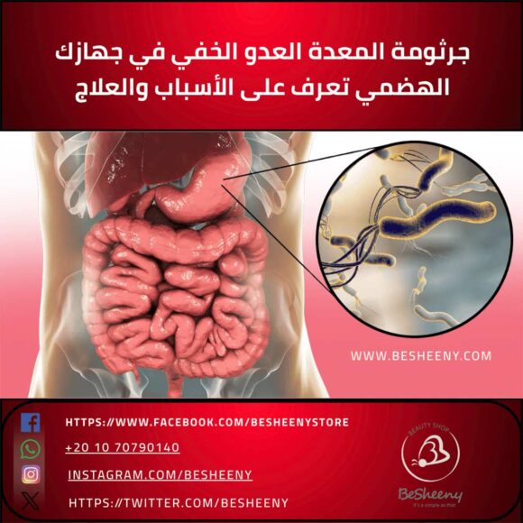 جرثومة المعدة العدو الخفي في جهازك الهضمي تعرف على الأسباب والعلاج