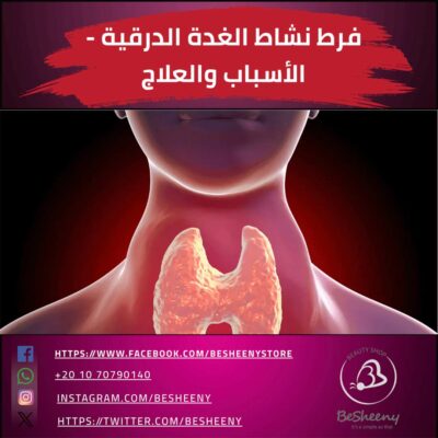 فرط نشاط الغدة الدرقية - الأسباب والعلاج
