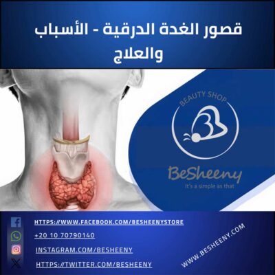 قصور الغدة الدرقية - الأسباب والعلاج