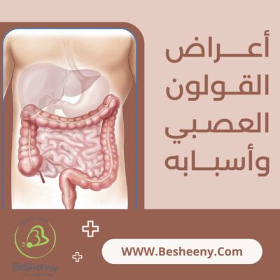 أعراض القولون العصبي وأسبابه وطرق العلاج