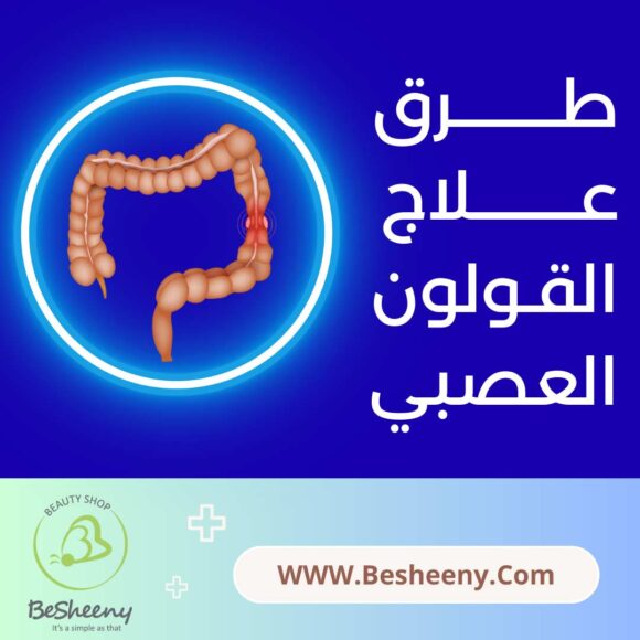 طرق علاج القولون العصبي IBS
