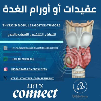 عقيدات أو اورام الغدة – الأعراض، التشخيص، الأسباب والعلاج