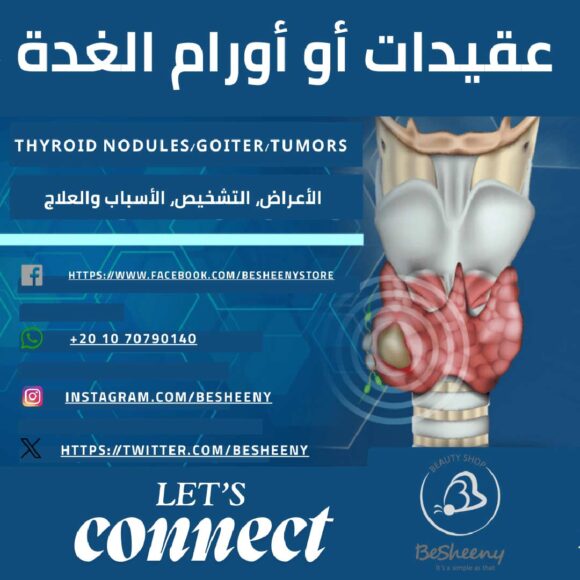 عقيدات أو اورام الغدة – الأعراض، التشخيص، الأسباب والعلاج
