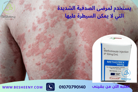 يُستخدم هذا الدواء بوصفة طبية فقط وتحت إشراف مختص