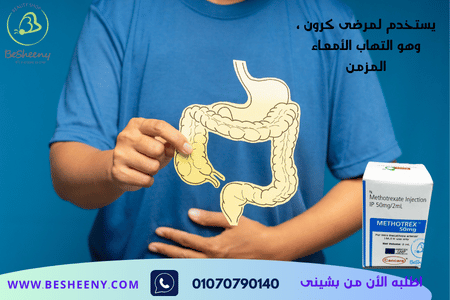 ميثوتريكست فيال لمرضى كرون METHOTREXATE
