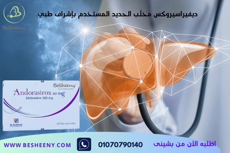 ديفيراسيروكس مخلب الحديد المستخدم بإشراف طبي
