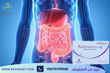أندوراسيروكس 360 مجم – تنظيم مستويات الحديد باشراف طبى