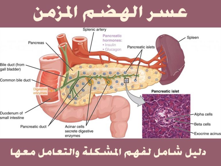 عسر الهضم المزمن — دليل شامل لفهم المشكلة والتعامل معها
