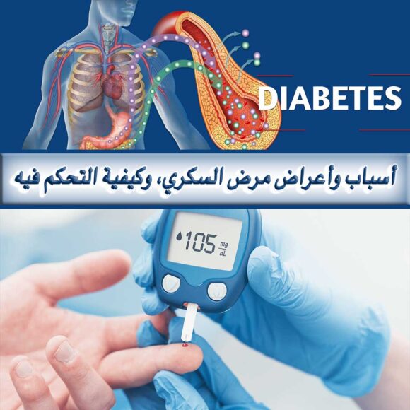 أسباب وأعراض مرض السكري،