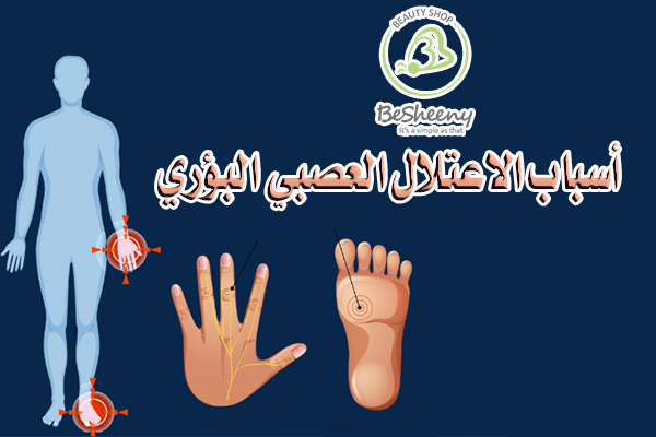 منها المحفزات الغذائية والمحفزات السلوكية ونمط الحياة أيضا الأسباب البنيوية