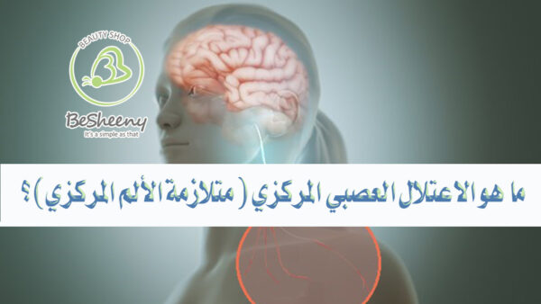 حالة مزمنة يشعر فيها الشخص بألم مستمر نتيجة خلل في الجهاز العصبي