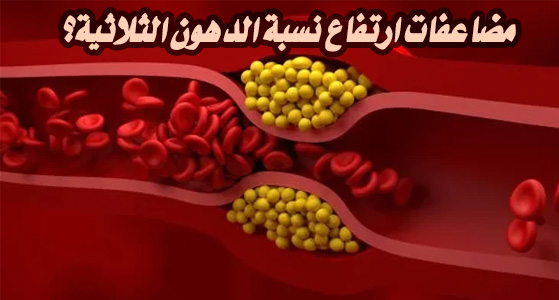 مضاعفات ارتفاع نسبة الدهون الثلاثية