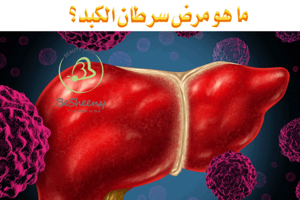 هو نوع من السرطان يبدأ في خلايا الكبد.
