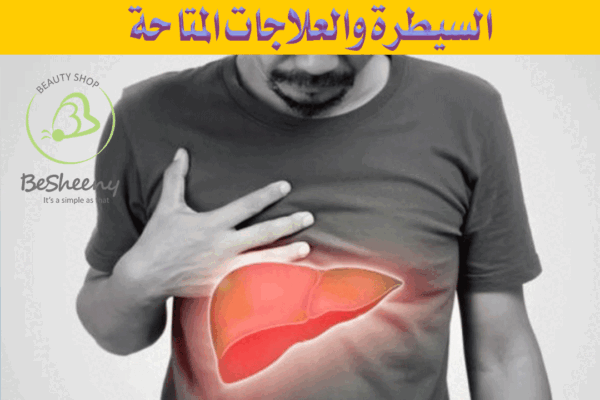 قد يعتمد علاج سرطان الكبد على العلاجات الدوائية أيضا التدخلات الجراحية