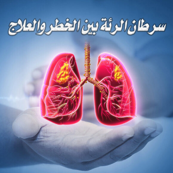 سرطان الرئة بين الخطر والعلاج