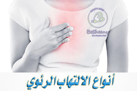 بعض الفيروسات المسببة لنزلات البرد والإنفلونزا قد تؤدي إلى الالتهاب الرئوي