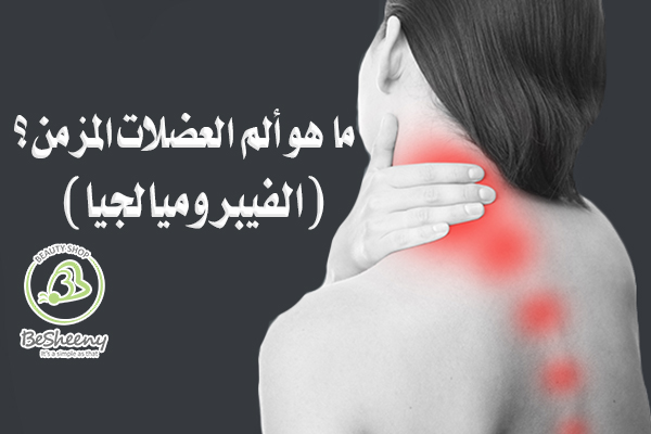 هي حالة طويلة الأمد تتمثل في آلام منتشرة في أنحاء الجسم. تحدث هذه الآلام غالبًا مصحوبة بإرهاق عام