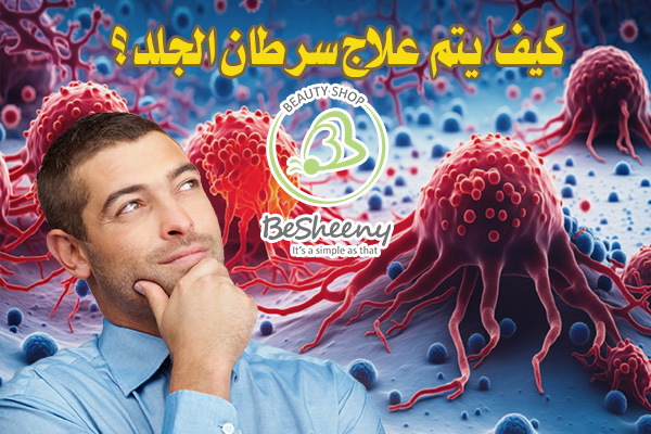 هناك علاجات عدة منها العلاج بالتبريد