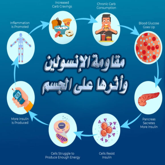 مقاومة الإنسولين وأثرها على الجسم