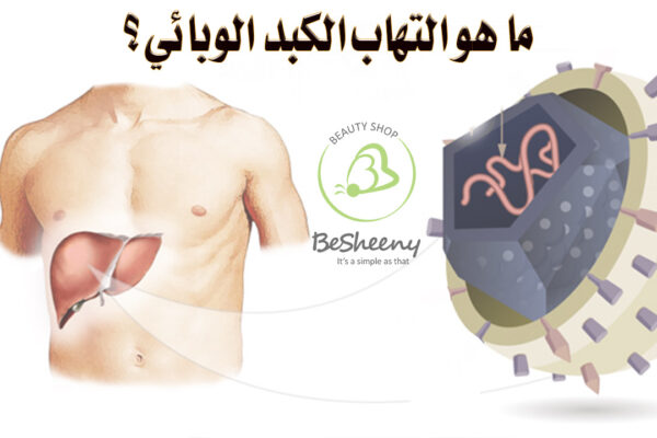 هو عدوى فيروسية تصيب الكبد