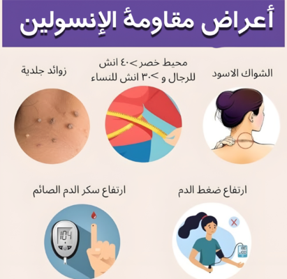 أعراض مقاومة الإنسولين