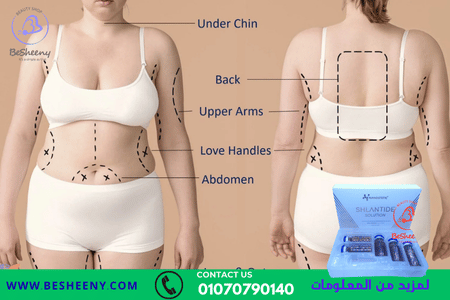 حقن تخسيس SHLANTIDE