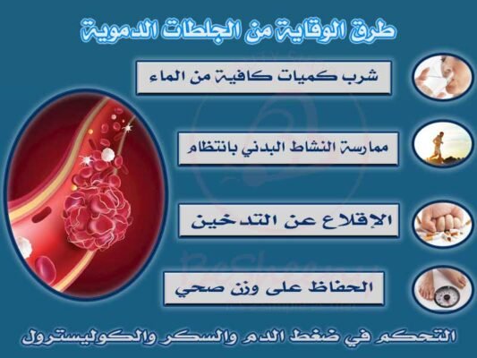 طرق الوقاية من الجلطات الدموية