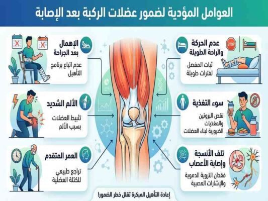 العوامل المؤدية لضمور عضلات الركبة بعد الإصابة