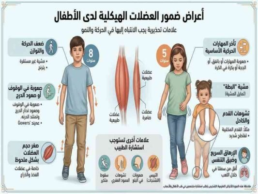 أعراض ضمور العضلات الهيكلية لدي الاطفال