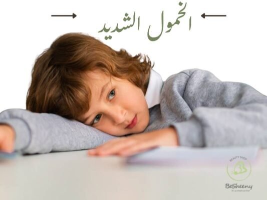 الخمول الشديد