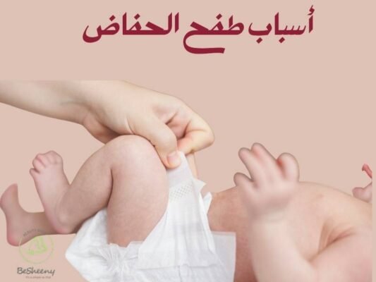 أسباب طفح الحفاض