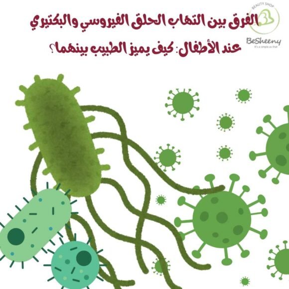 الفرق بين التهاب الحلق الفيروسي والبكتيري عند الأطفال كيف يميز الطبيب بينهما؟ (1)