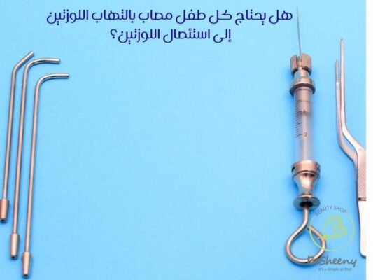 هل يحتاج كل طفل مصاب بالتهاب اللوزتين إلى استئصال اللوزتين؟