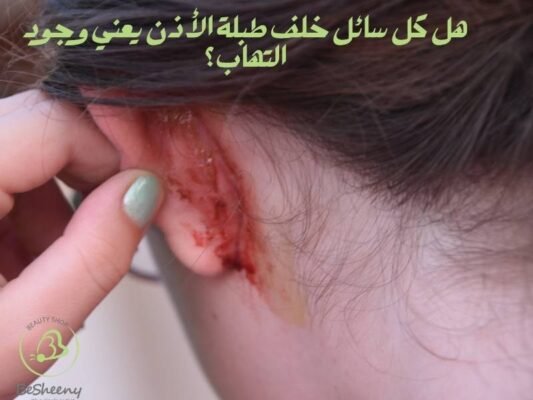 هل كل سائل خلف طبلة الأذن يعني وجود التهاب؟
