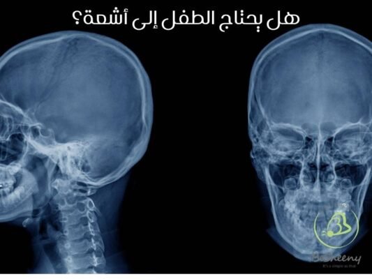 هل يحتاج الطفل إلي أشعة
