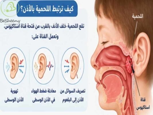 كيف ترتبط اللحمية بالأذن