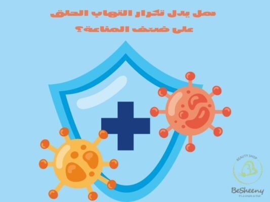 هل يدل تكرار التهاب الحلق على ضعف المناعة؟