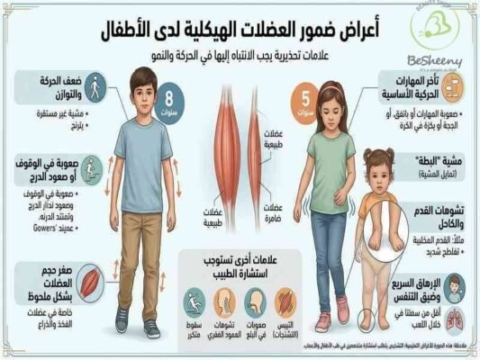 اعراض ضمور العضلات الهيكلية