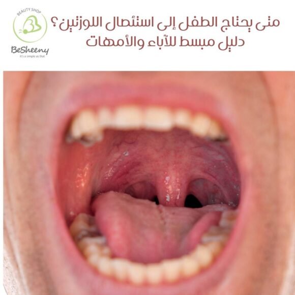 متى يحتاج الطفل إلى استئصال اللوزتين؟ دليل مبسط للآباء والأمهات