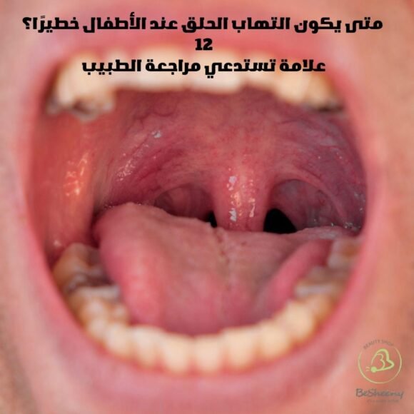 متى يكون التهاب الحلق عند الأطفال خطيرًا؟ 12 علامة تستدعي مراجعة الطبيب (1)