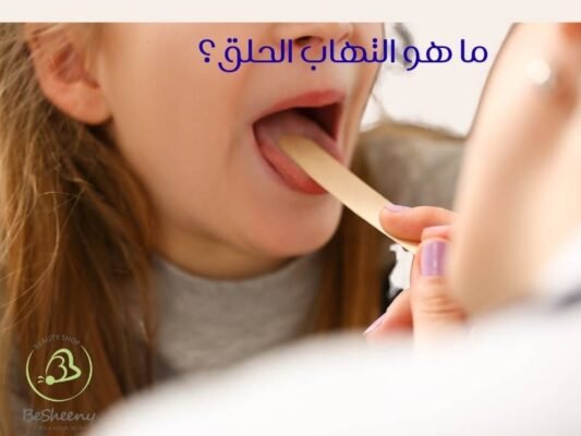 ما هو التهاب الحلق؟