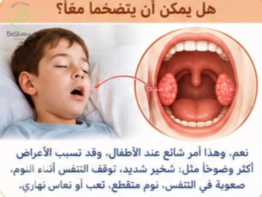 هل يمكن ان يتضخما معا