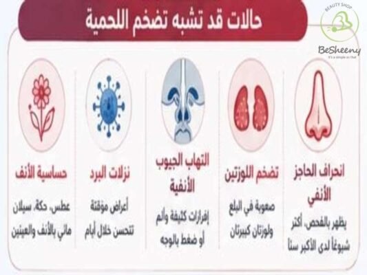 حالات تضخم اللحمية